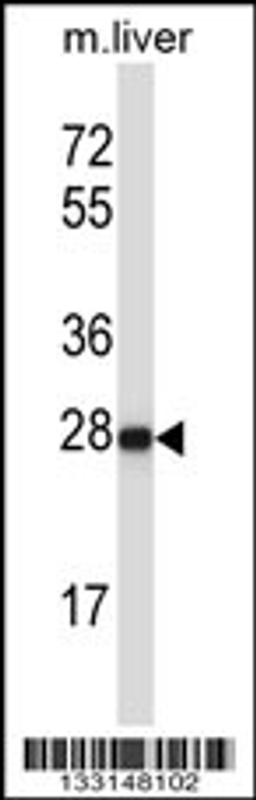 Western blot analysis in mouse liver tissue lysates (35ug/lane).