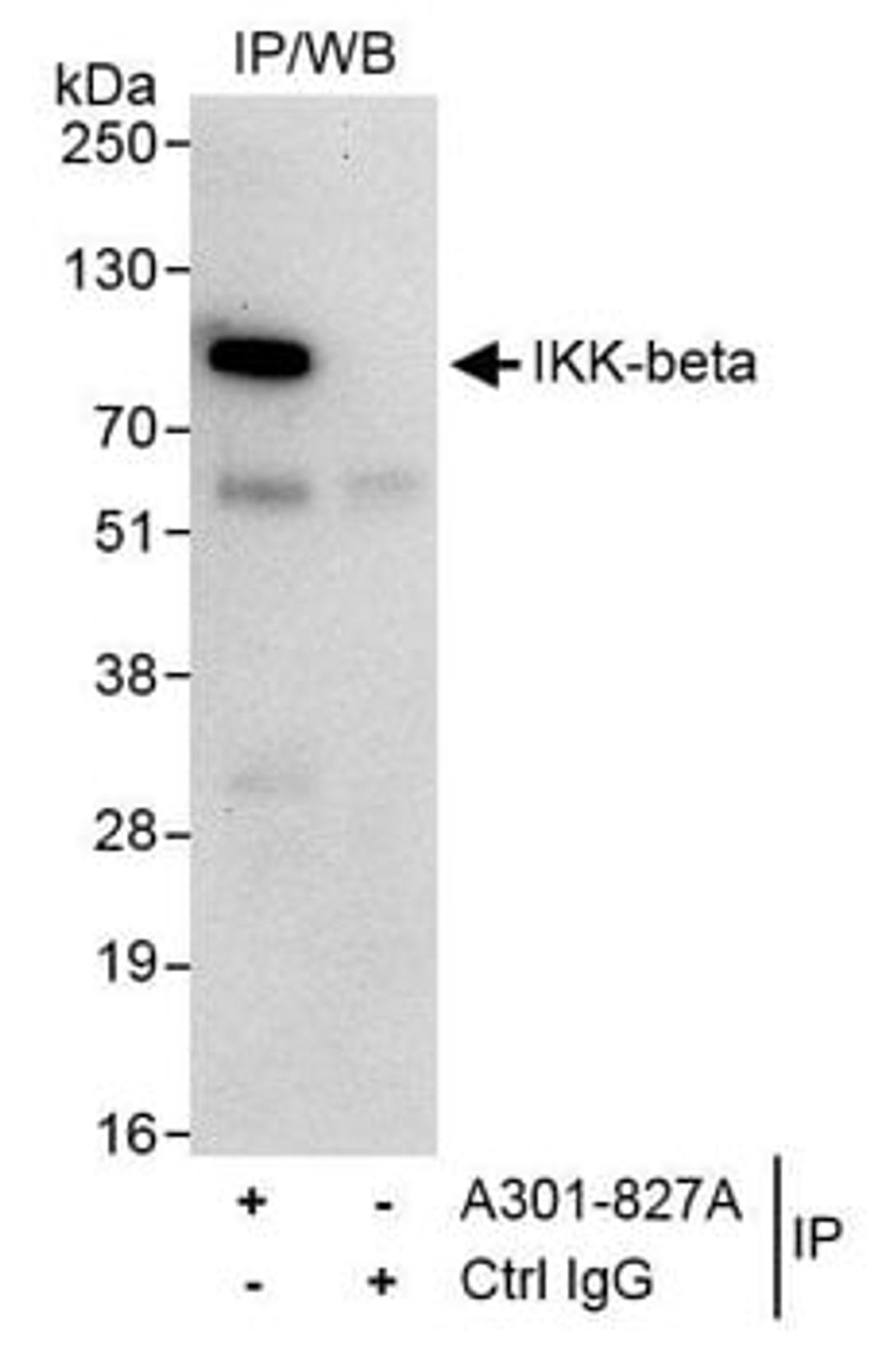 Detection of human IKK-beta by western blot of immunoprecipitatesion.