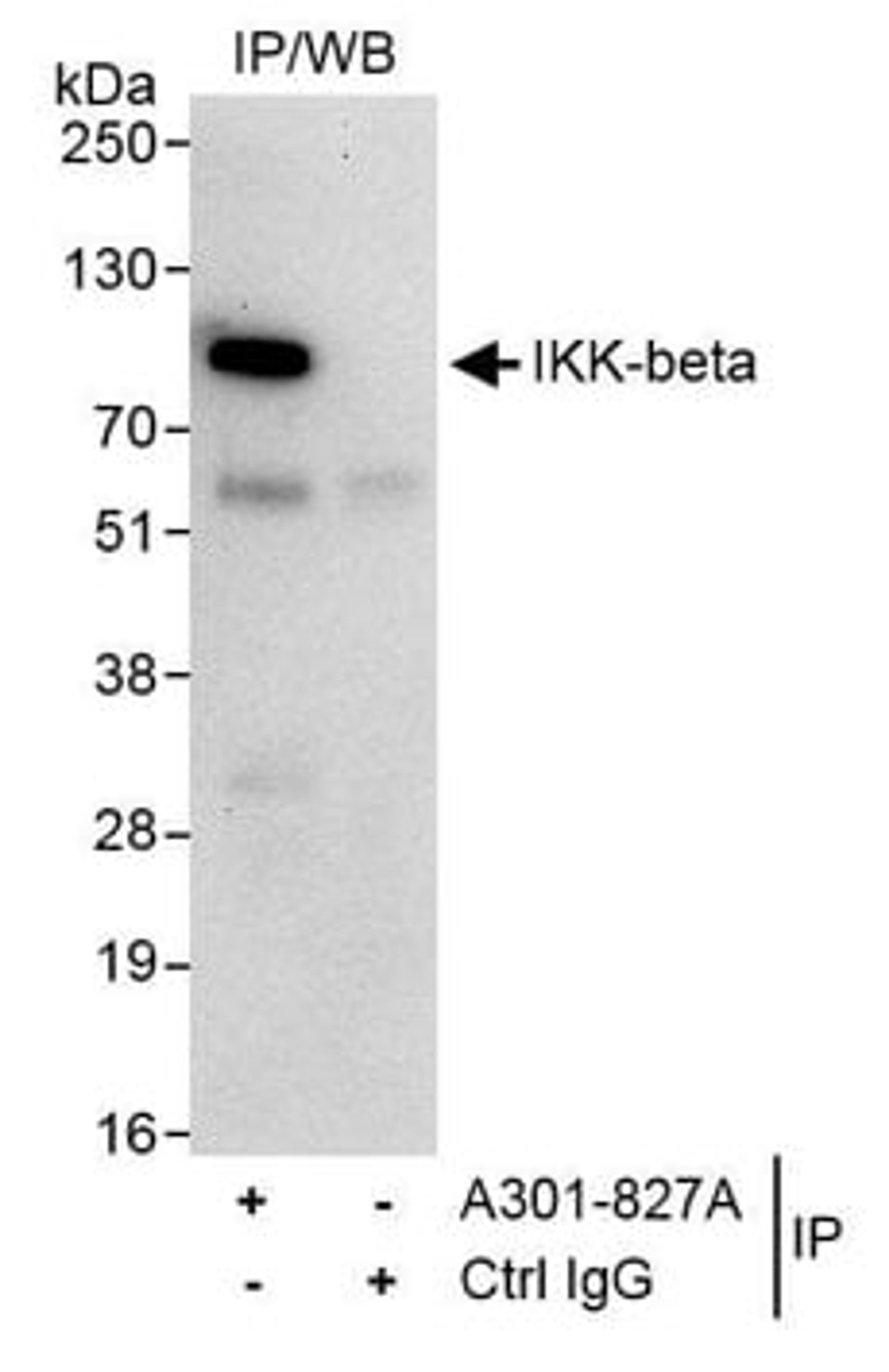 Detection of human IKK-beta by western blot of immunoprecipitatesion.