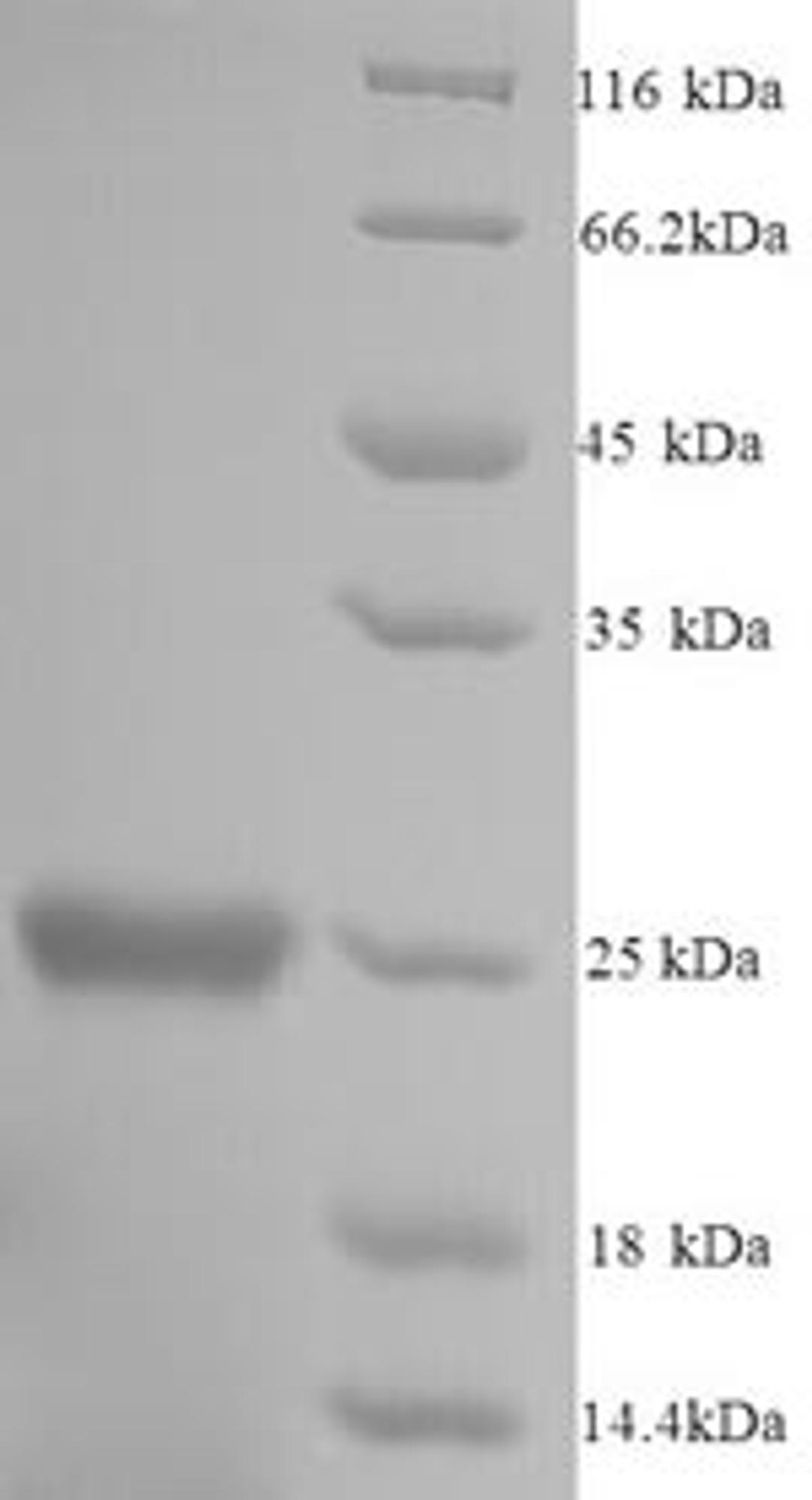 (Tris-Glycine gel) Discontinuous SDS-PAGE (reduced) with 5% enrichment gel and 15% separation gel.