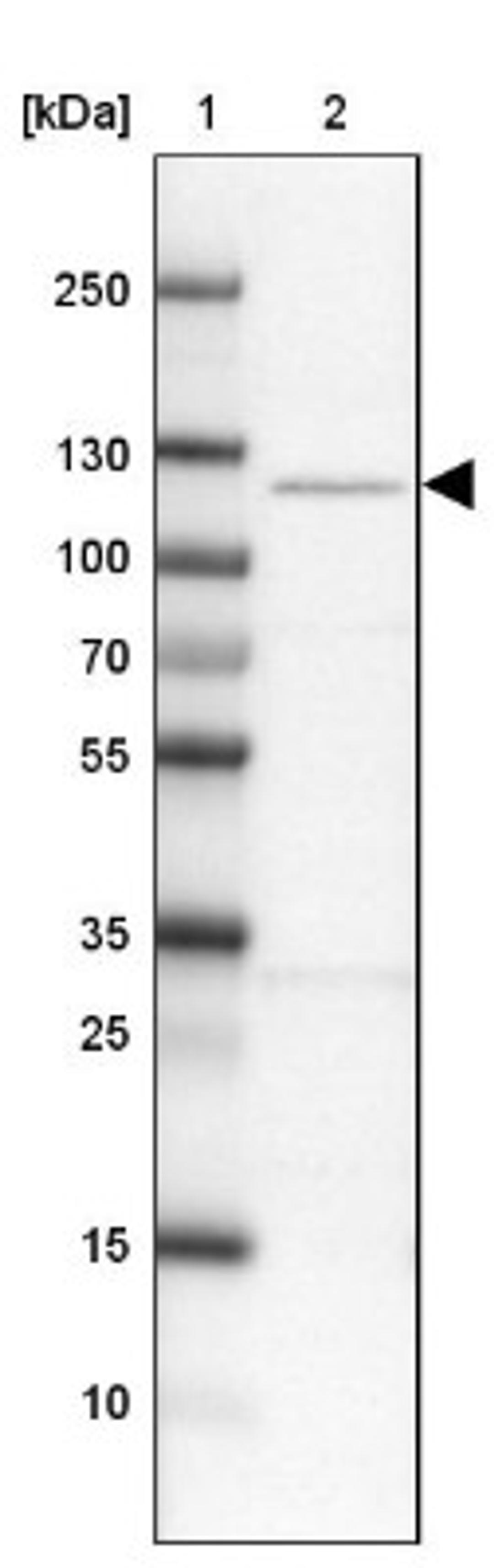 Western Blot: GRID2IP Antibody [NBP1-94174] - Lane 1: Marker [kDa] 250, 130, 100, 70, 55, 35, 25, 15, 10<br/>Lane 2: U-251 MG