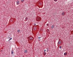 Human brain cortex tissue stained with CYCS Antibody, alkaline phosphatase-streptavidin and chromogen.