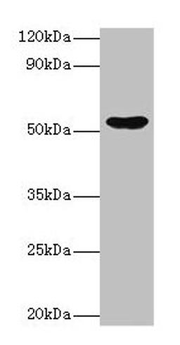 Western blot. All lanes: EPHX1 antibody at 2µg/ml + Hela whole cell lysate. Secondary. Goat polyclonal to rabbit IgG at 1/10000 dilution. Predicted band size: 53 kDa. Observed band size: 53 kDa