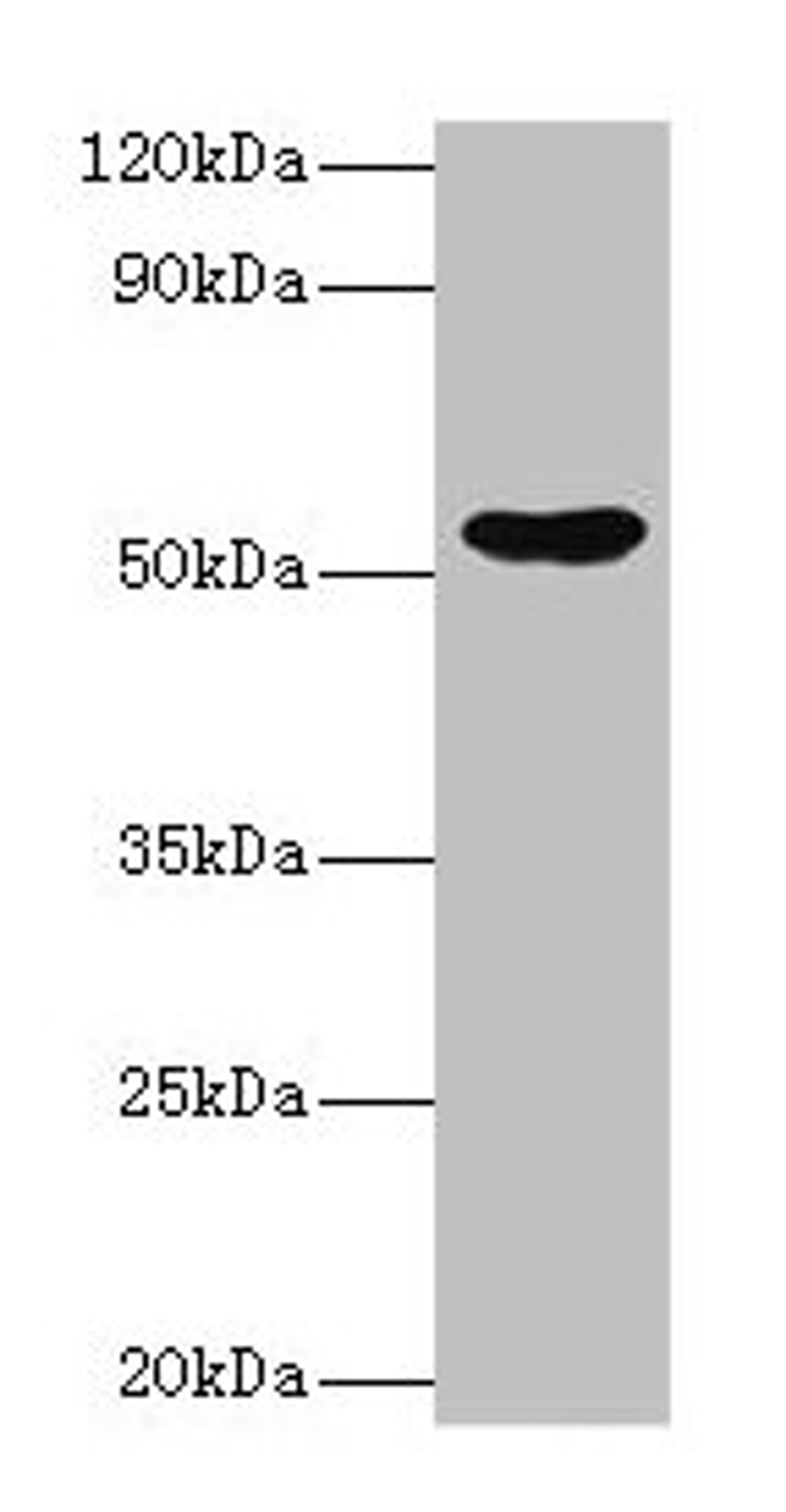 Western blot. All lanes: EPHX1 antibody at 2µg/ml + Hela whole cell lysate. Secondary. Goat polyclonal to rabbit IgG at 1/10000 dilution. Predicted band size: 53 kDa. Observed band size: 53 kDa