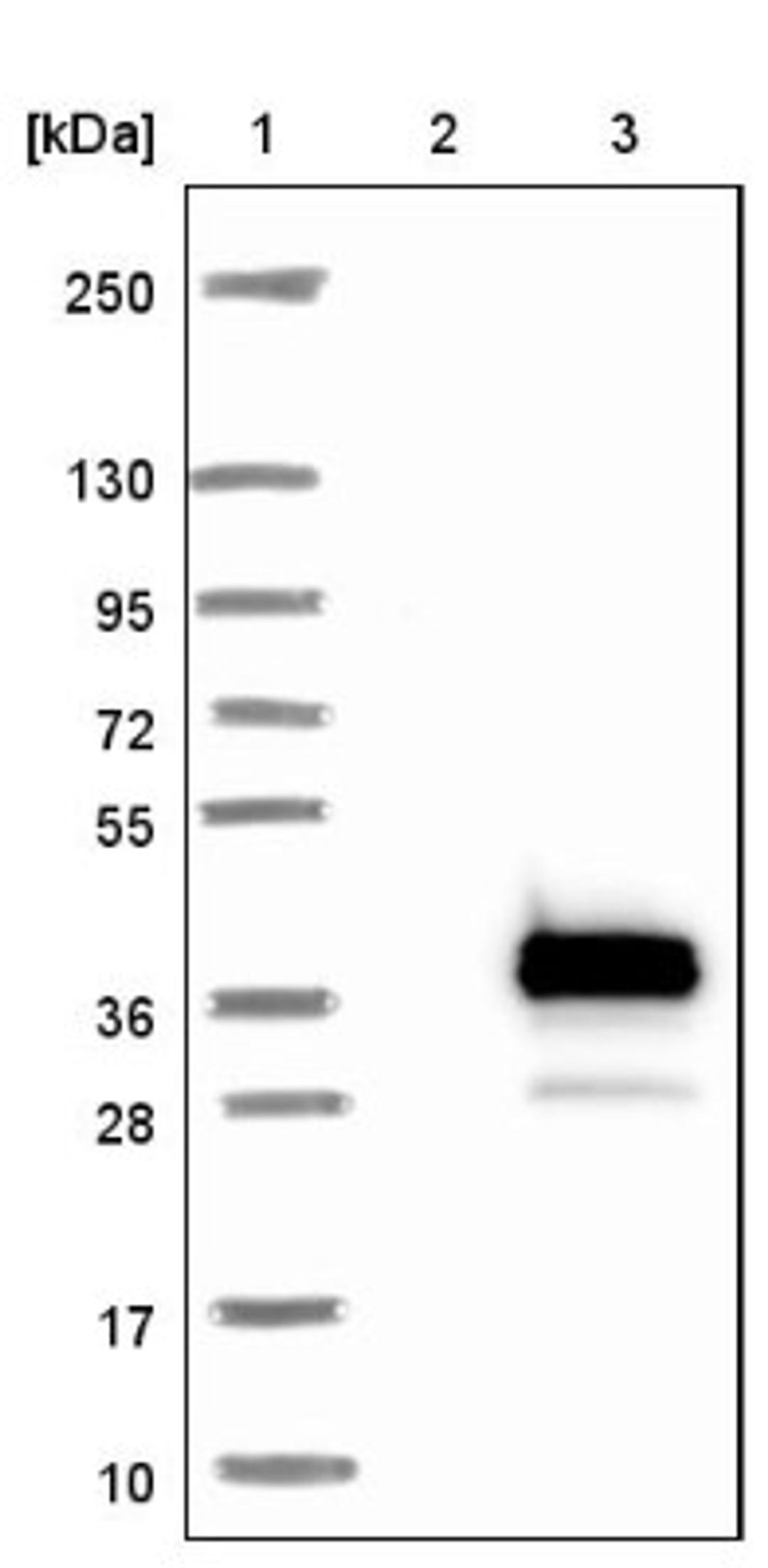 Western Blot: RPIA Antibody [NBP1-86214] - Lane 1: Marker [kDa] 250, 130, 95, 72, 55, 36, 28, 17, 10<br/>Lane 2: Negative control (vector only transfected HEK293T lysate)<br/>Lane 3: Over-expression lysate (Co-expressed with a C-terminal myc-DDK tag (~3.1 kDa) in mammalian HEK293T cells, LY408273)