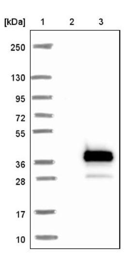 Western Blot: RPIA Antibody [NBP1-86214] - Lane 1: Marker [kDa] 250, 130, 95, 72, 55, 36, 28, 17, 10<br/>Lane 2: Negative control (vector only transfected HEK293T lysate)<br/>Lane 3: Over-expression lysate (Co-expressed with a C-terminal myc-DDK tag (~3.1 kDa) in mammalian HEK293T cells, LY408273)