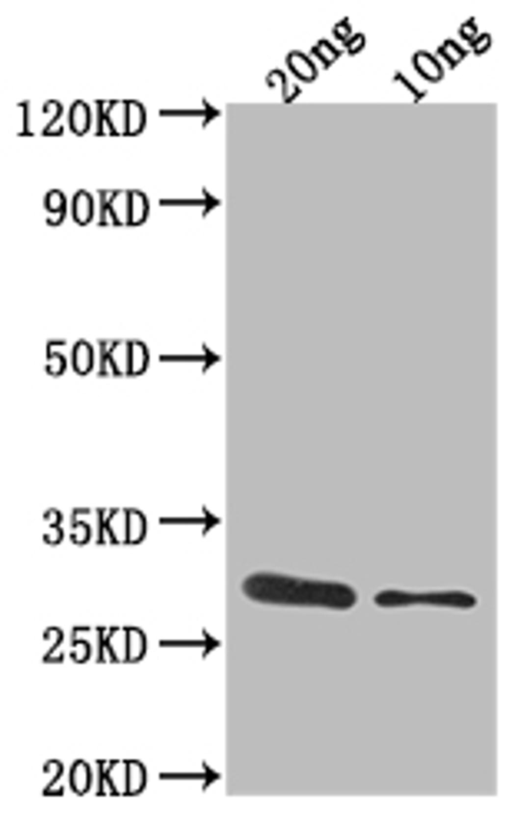 Western Blot. Positive WB detected in Recombinant protein. All lanes: ygcB antibody at 1:2000. Secondary. Goat polyclonal to rabbit IgG at 1/50000 dilution. Predicted band size: 31.8 kDa. Observed band size: 32 kDa. 