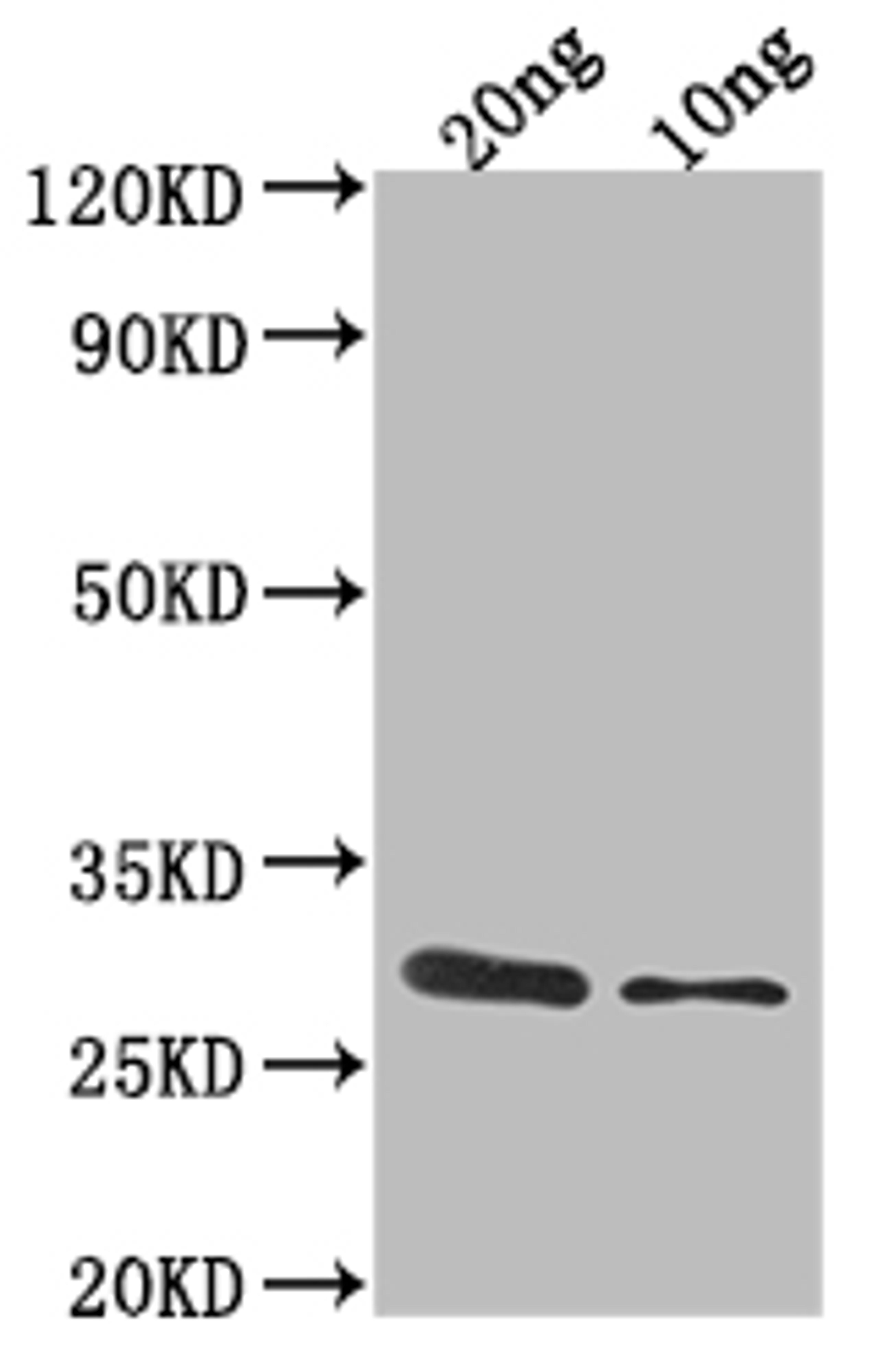 Western Blot. Positive WB detected in Recombinant protein. All lanes: ygcB antibody at 1:2000. Secondary. Goat polyclonal to rabbit IgG at 1/50000 dilution. Predicted band size: 31.8 kDa. Observed band size: 32 kDa. 