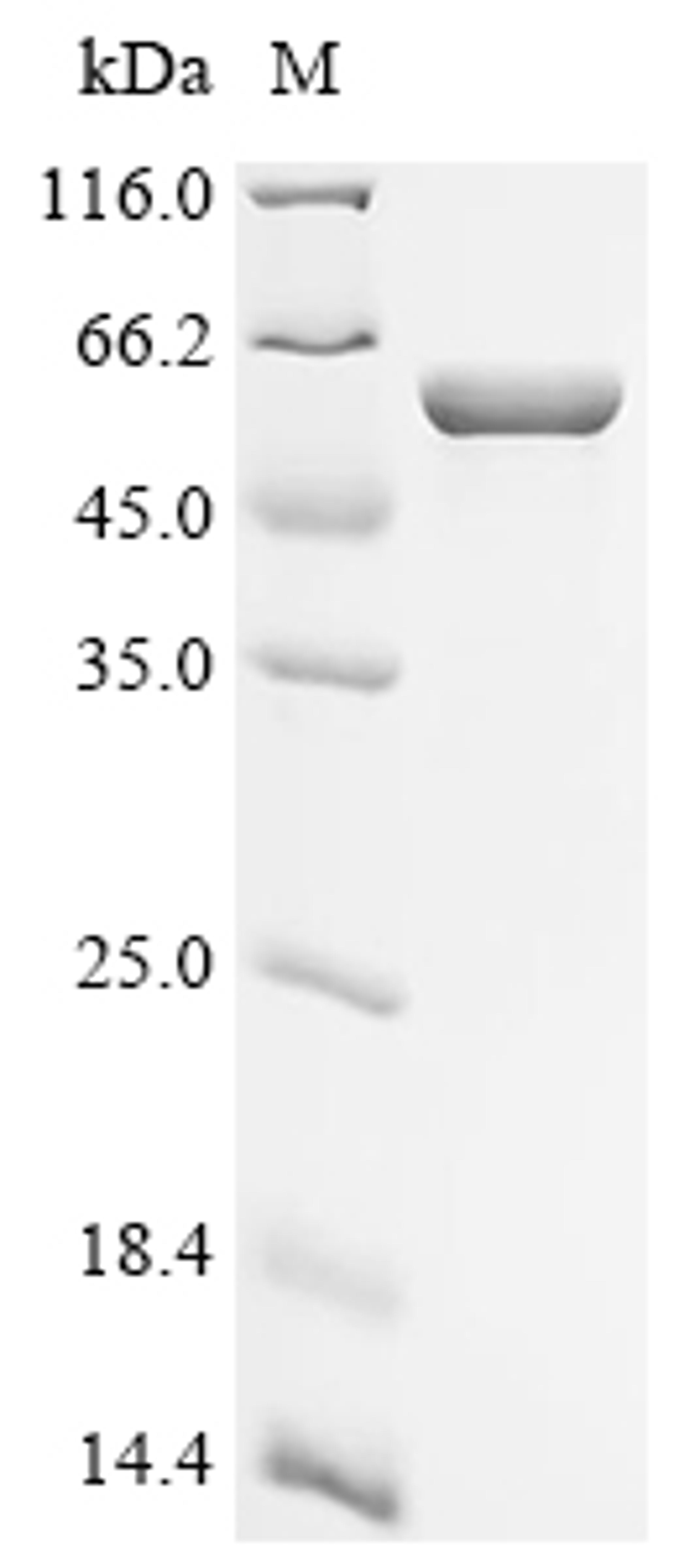 (Tris-Glycine gel) Discontinuous SDS-PAGE (reduced) with 5% enrichment gel and 15% separation gel.