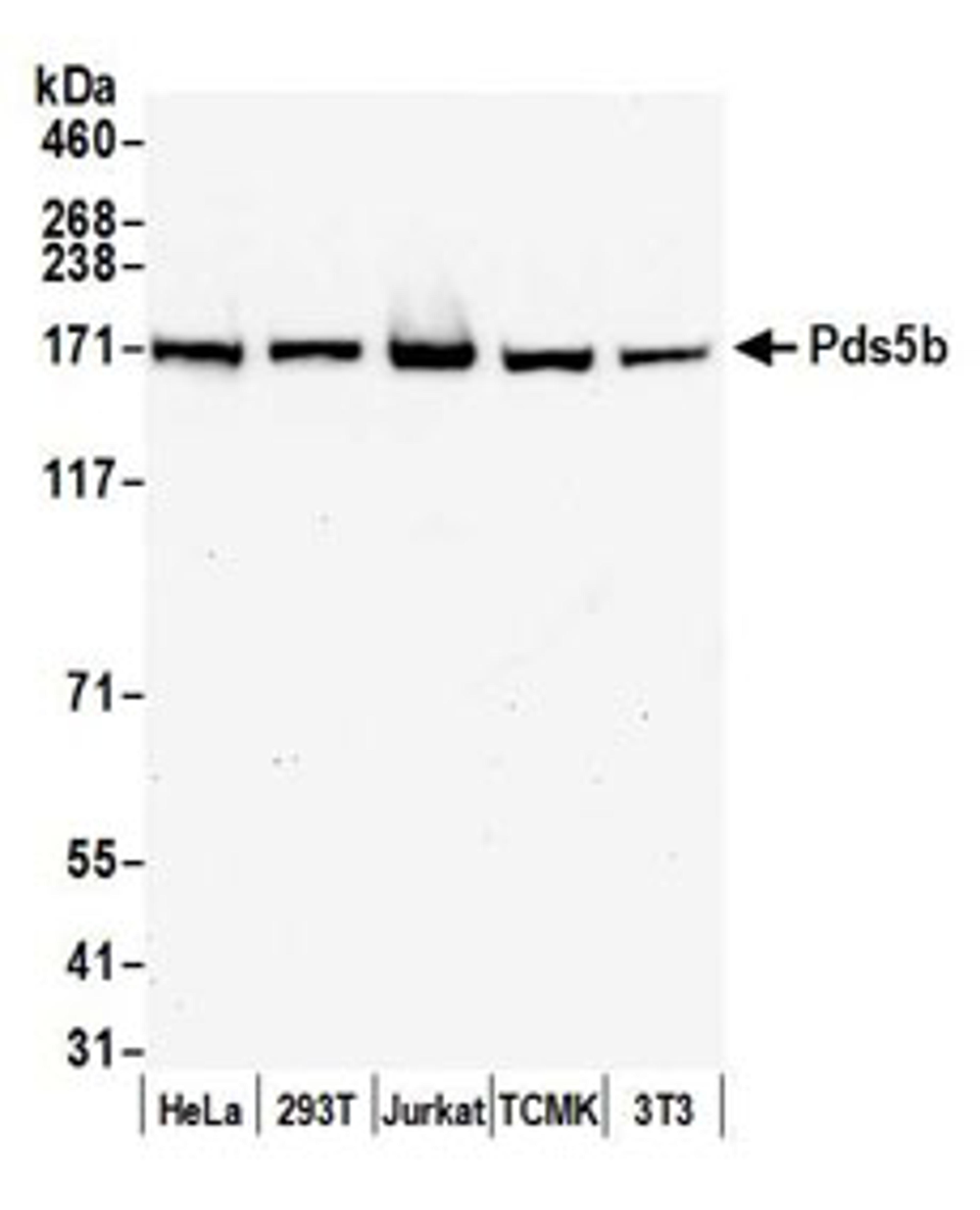 Detection of human and mouse Pds5b by western blot.