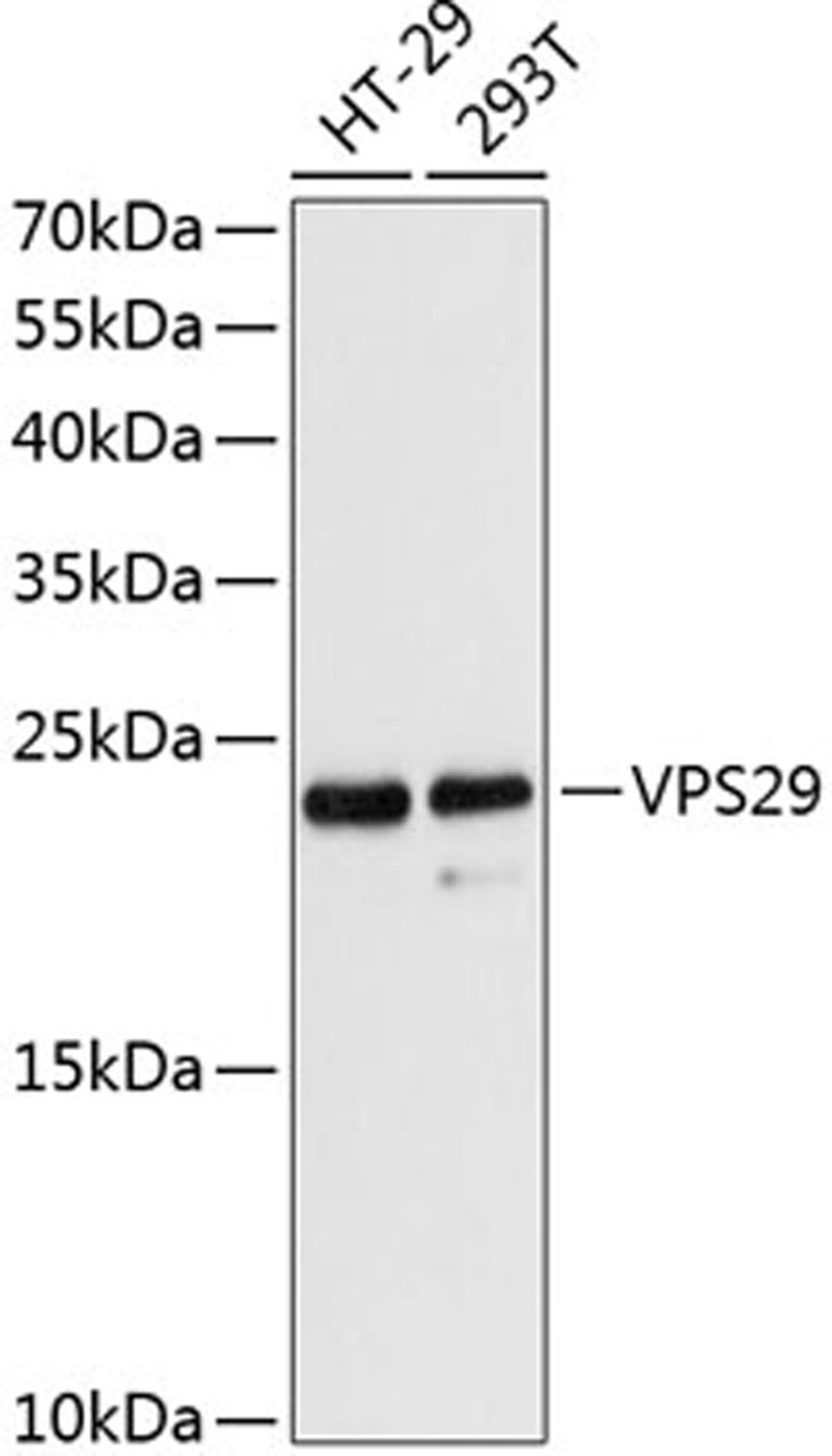 Western blot - VPS29 antibody (A13098)