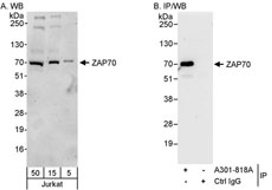 Detection of human ZAP70 by western blot and immunoprecipitation.