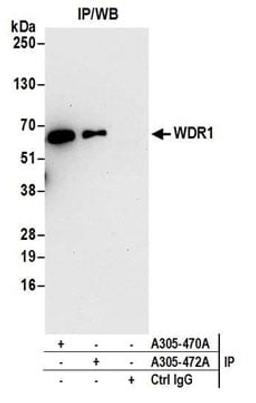 Detection of human WDR1 by western blot of immunoprecipitates.