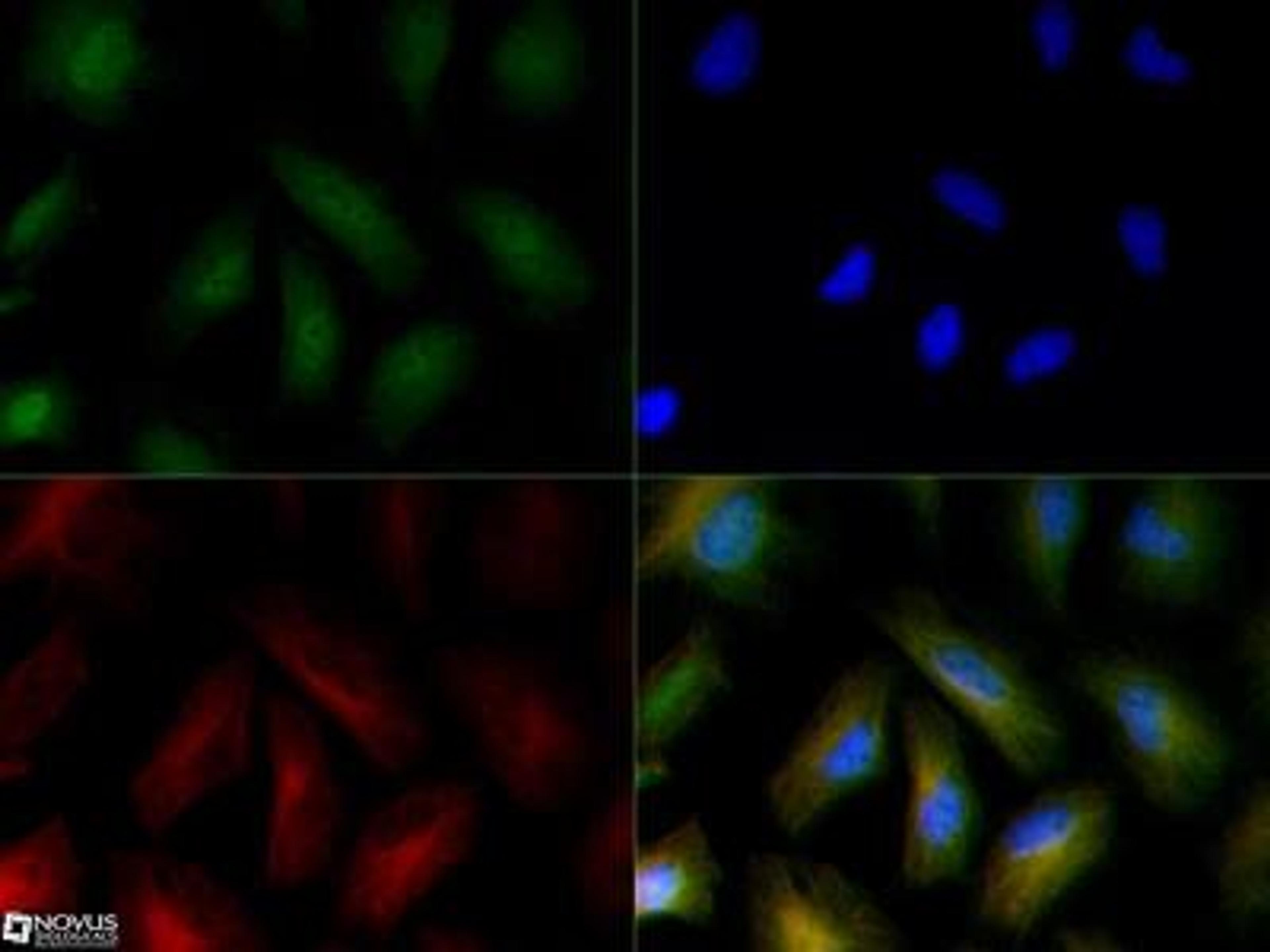 Immunocytochemistry/Immunofluorescence: FFAR4/GPR120 Antibody [NBP1-00858] - GPR120 antibody was tested at 1:50 in HeLa cells with Dylight 488 (green). Nuclei and alpha-tubulin were counterstained with DAPI (blue) and Dylight 550 (red). Image objective 40x.