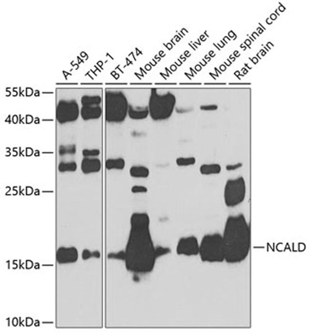 Western blot - NCALD antibody (A8000)