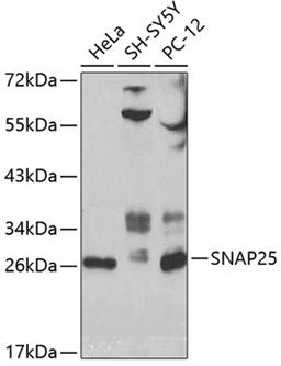 Western blot - SNAP25 antibody (A0986)