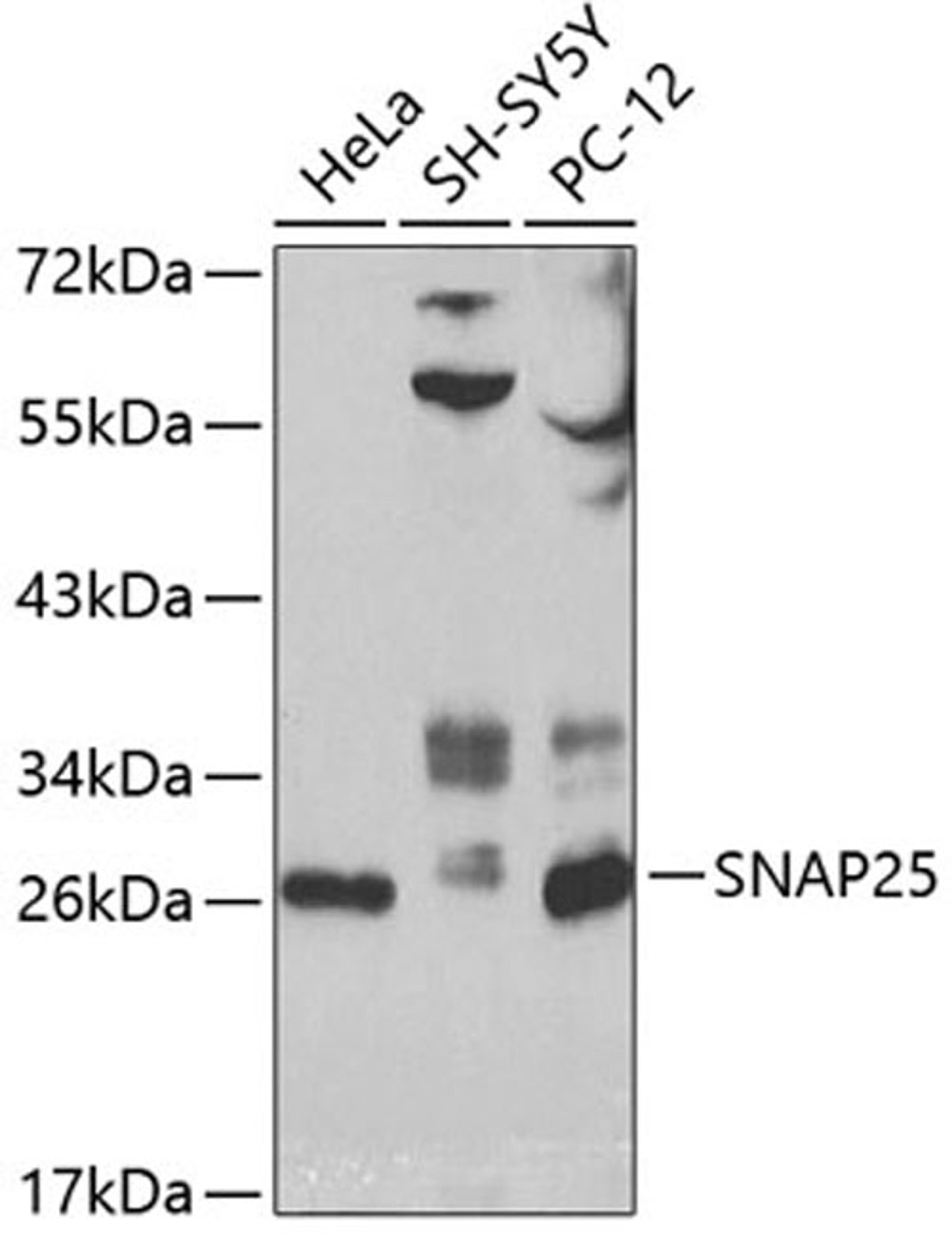 Western blot - SNAP25 antibody (A0986)