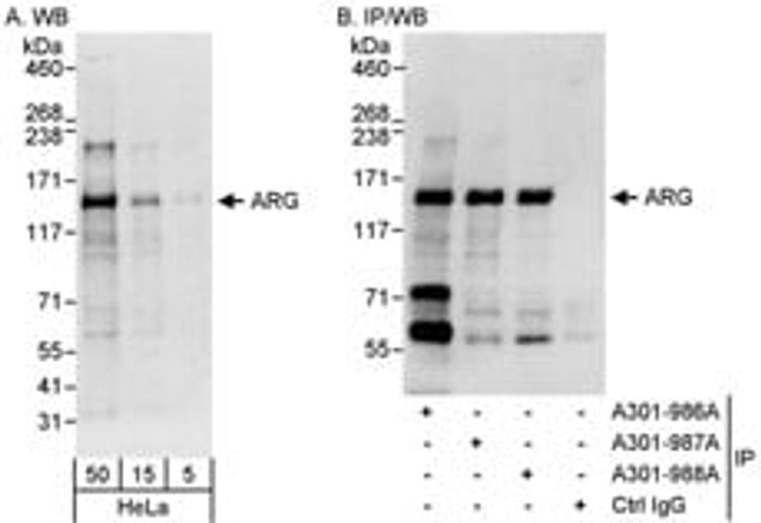 Detection of human ARG by western blot and immunoprecipitation.