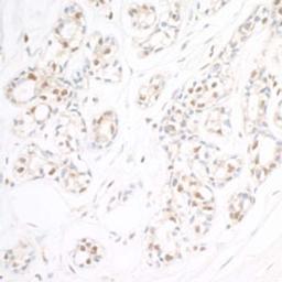 Detection of human RAP80 by immunohistochemistry.