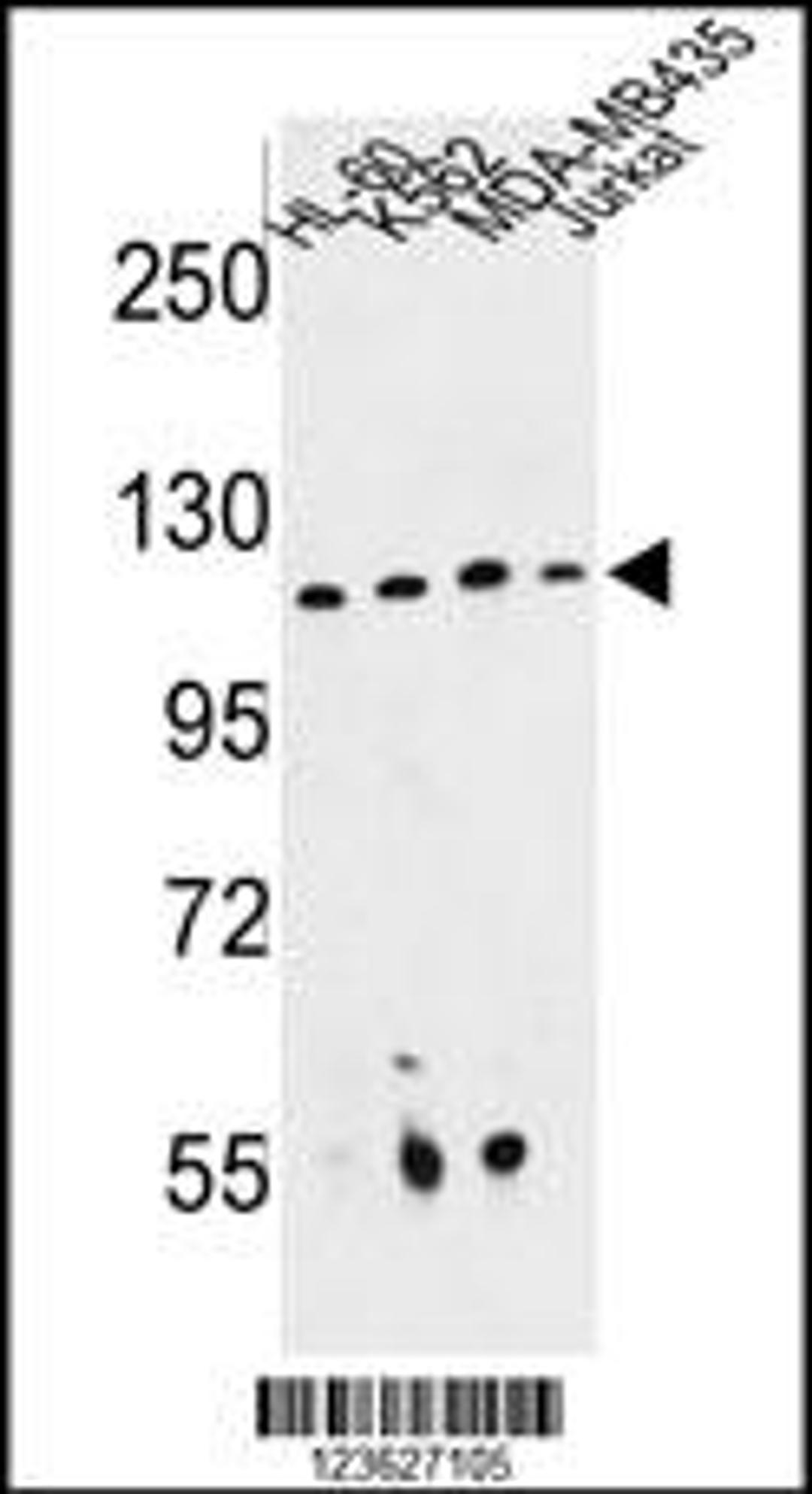 Western blot analysis of RPGRIP1 Antibody in HL-60, K562, MDA-MB435, Jurkat cell line lysates (35ug/lane)