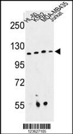 Western blot analysis of RPGRIP1 Antibody in HL-60, K562, MDA-MB435, Jurkat cell line lysates (35ug/lane)