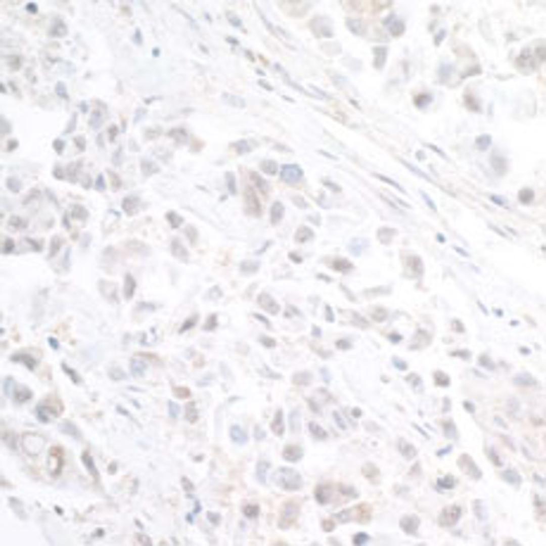 Detection of human INT11 by immunohistochemistry.