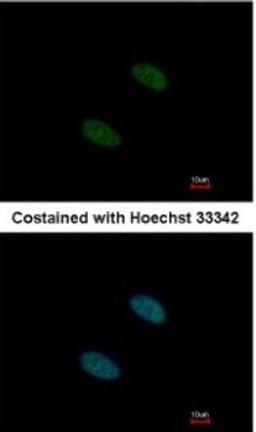 Immunocytochemistry/Immunofluorescence: SF3A2 Antibody [NBP2-15106] - Paraformaldehyde-fixed HeLa, using antibody at 1:500 dilution.