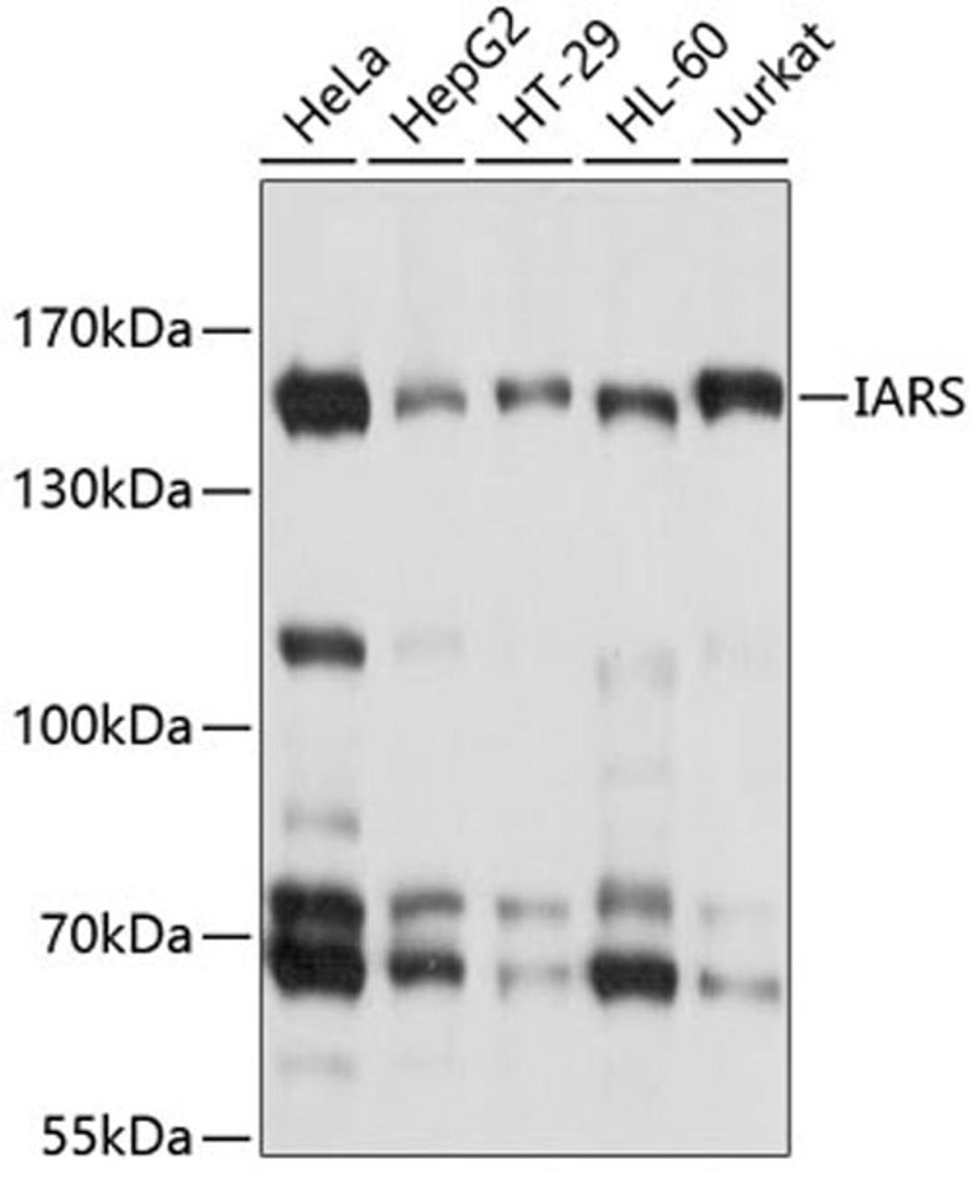 Western blot - IARS antibody (A10190)