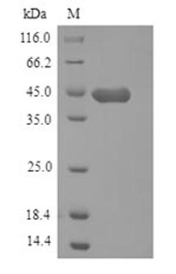 (Tris-Glycine gel) Discontinuous SDS-PAGE (reduced) with 5% enrichment gel and 15% separation gel.