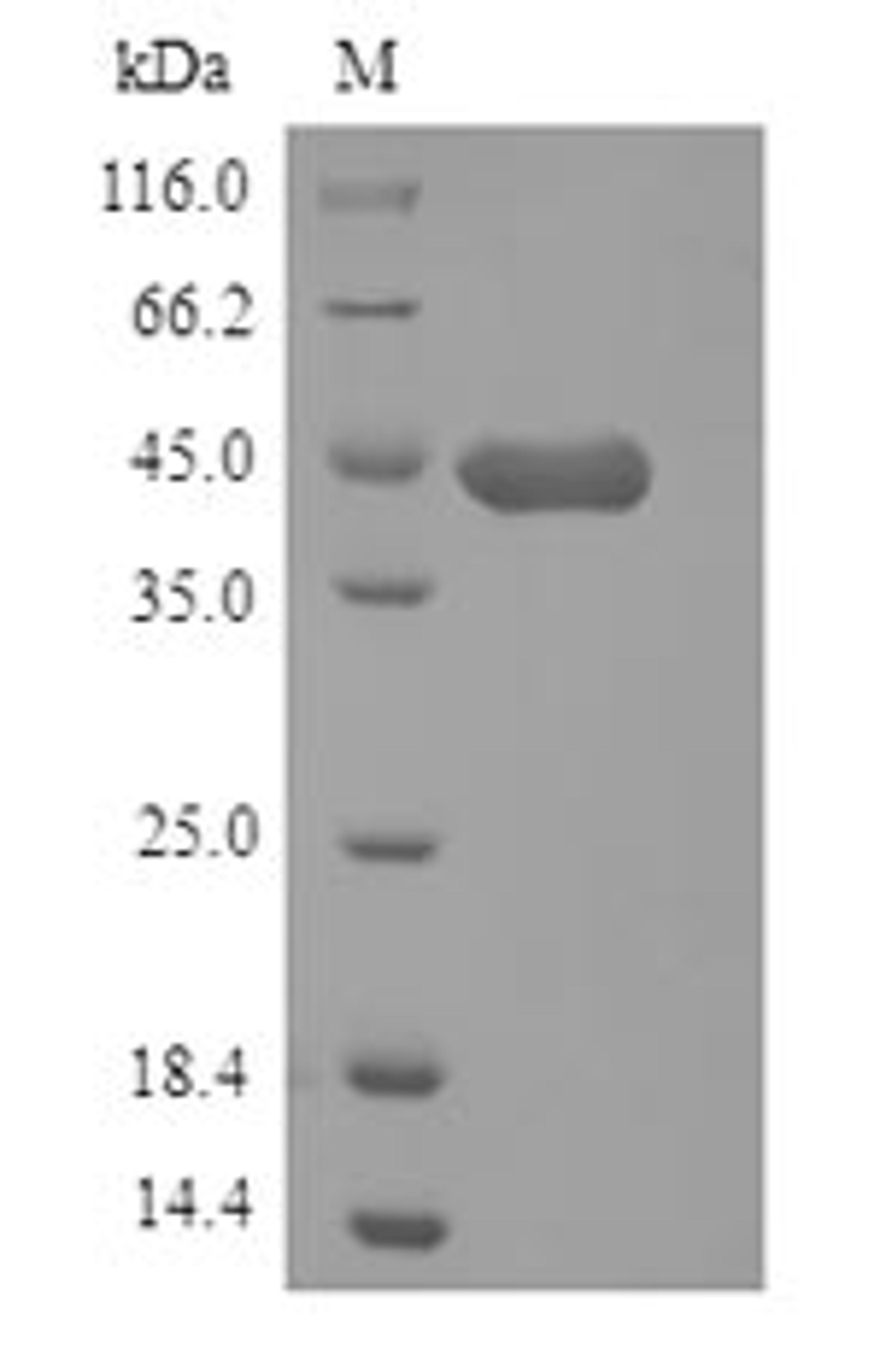 (Tris-Glycine gel) Discontinuous SDS-PAGE (reduced) with 5% enrichment gel and 15% separation gel.