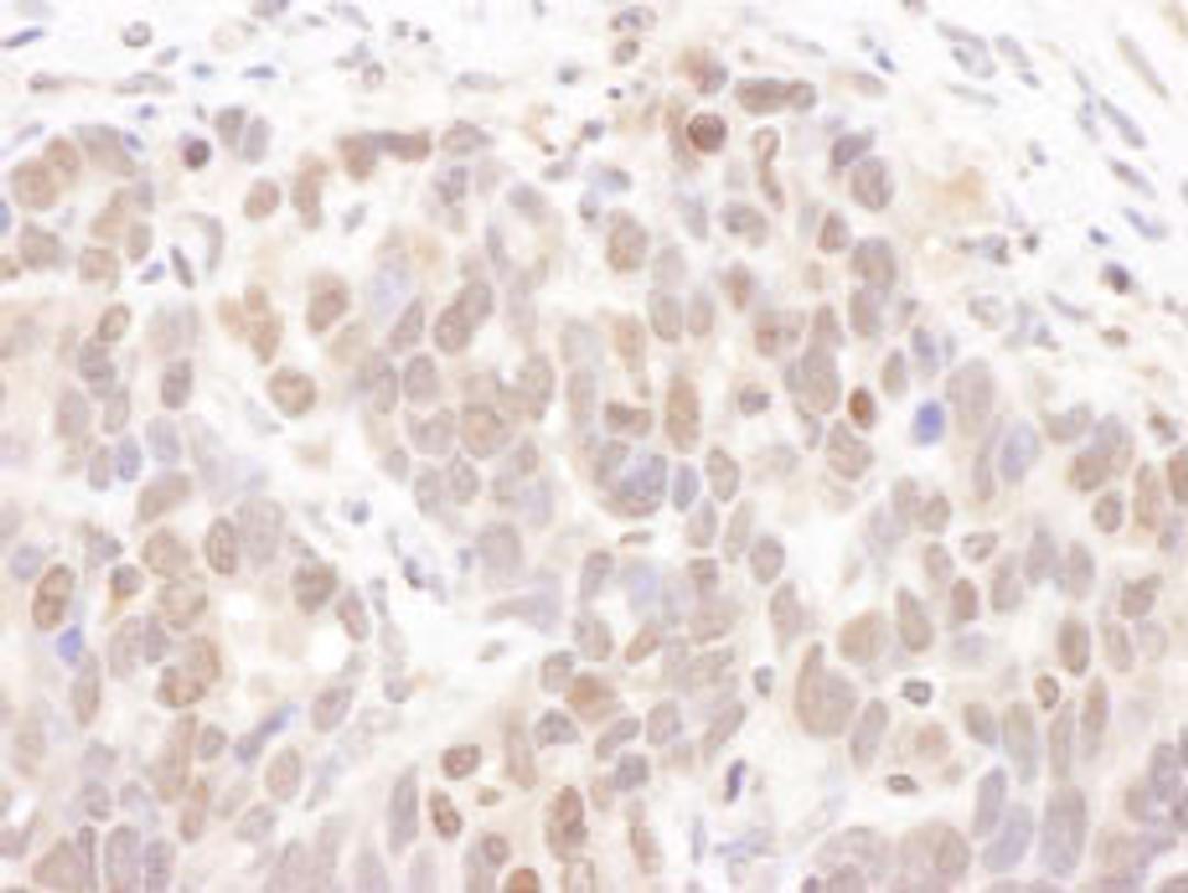 Detection of human CKII Alpha by immunohistochemistry.