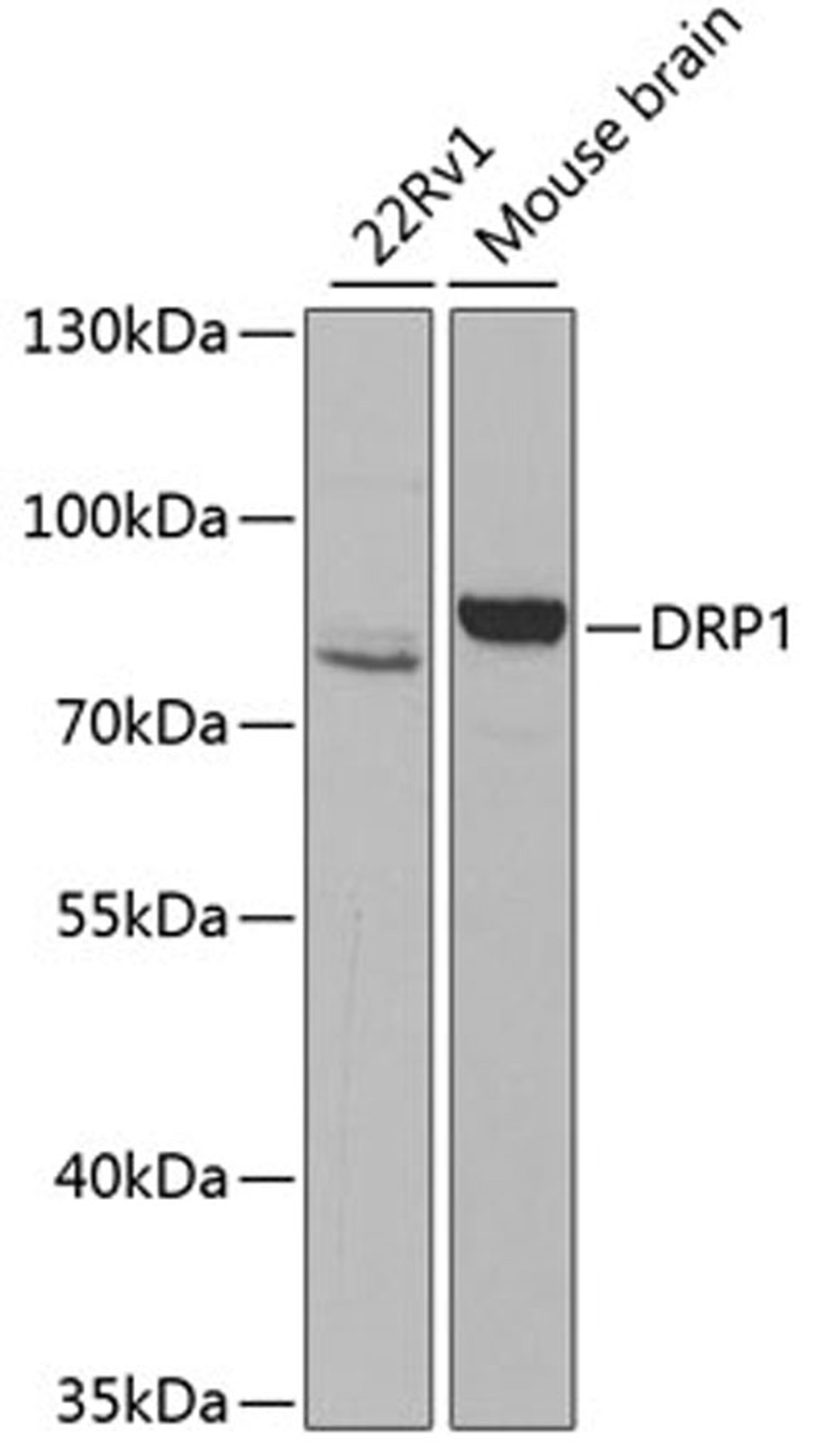 Western blot - DRP1 antibody (A2586)