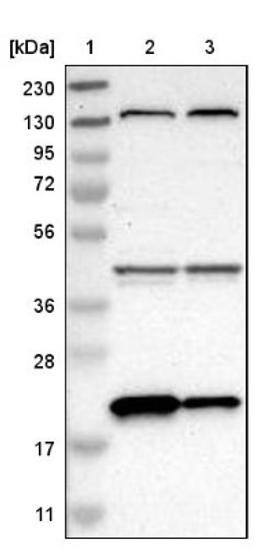 Western Blot: XTP3TPA Antibody [NBP1-85736] - Lane 1: Marker [kDa] 230, 130, 95, 72, 56, 36, 28, 17, 11<br/>Lane 2: Human cell line RT-4<br/>Lane 3: Human cell line U-251MG sp