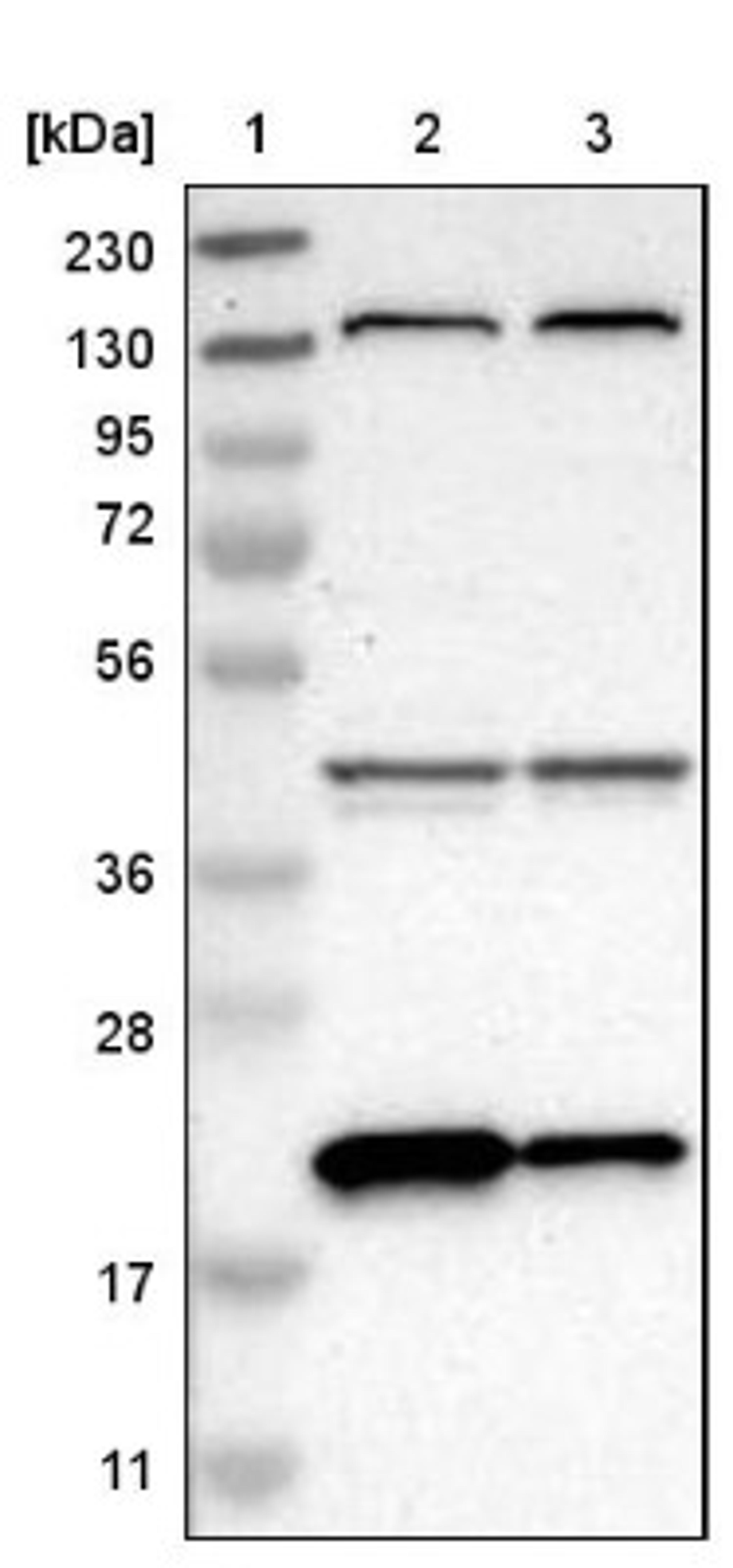 Western Blot: XTP3TPA Antibody [NBP1-85736] - Lane 1: Marker [kDa] 230, 130, 95, 72, 56, 36, 28, 17, 11<br/>Lane 2: Human cell line RT-4<br/>Lane 3: Human cell line U-251MG sp