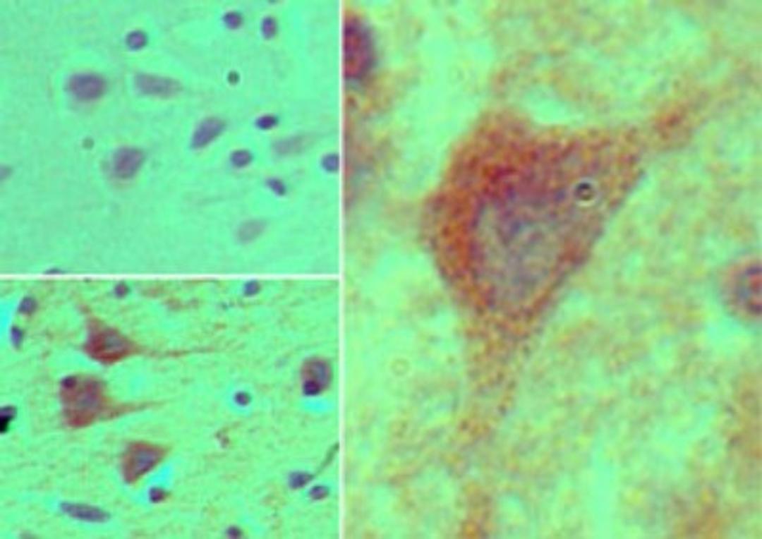 Immunohistochemistry-Paraffin: HOXB4 Antibody [NBP2-24561] - Analysis of HOXB4 in formalin-fixed, paraffin-embedded human brain tissue using an isotype control (top left) and this antibody (bottom left, right) at 5 ug/ml.