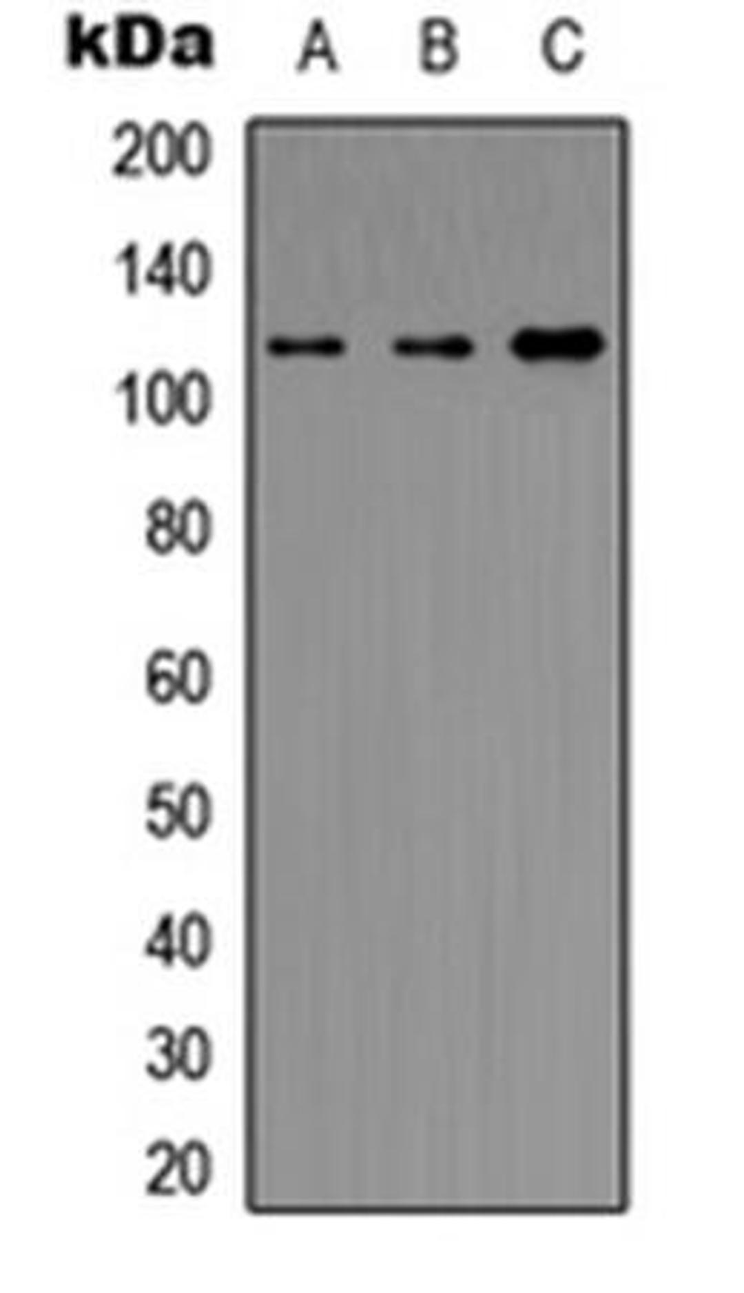 Western blot analysis of HeLa (Lane1), NIH3T3 (Lane2), rat intestine (Lane3) whole cell using Histone Deacetylase 5/9 antibody