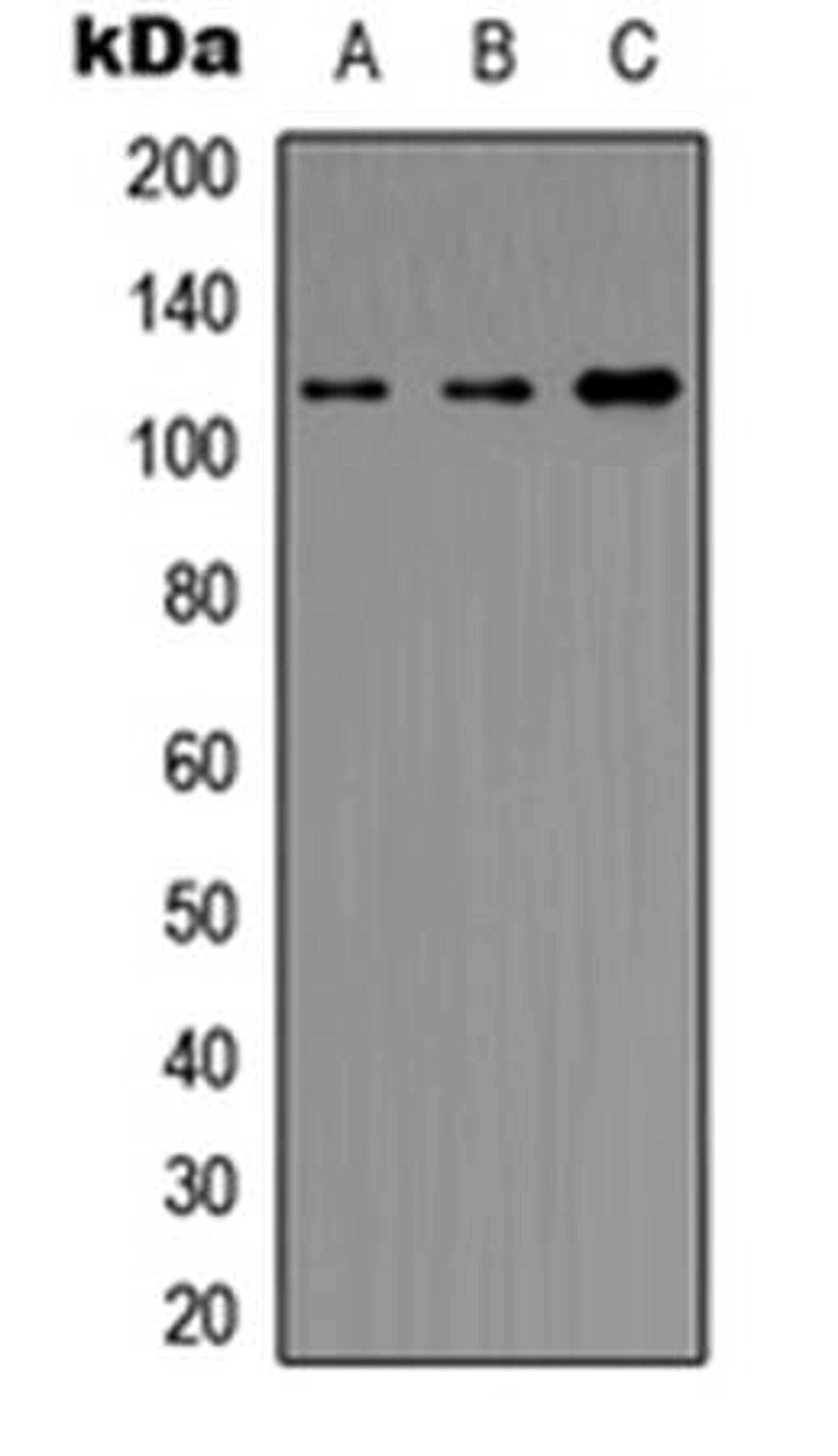 Western blot analysis of HeLa (Lane1), NIH3T3 (Lane2), rat intestine (Lane3) whole cell using Histone Deacetylase 5/9 antibody