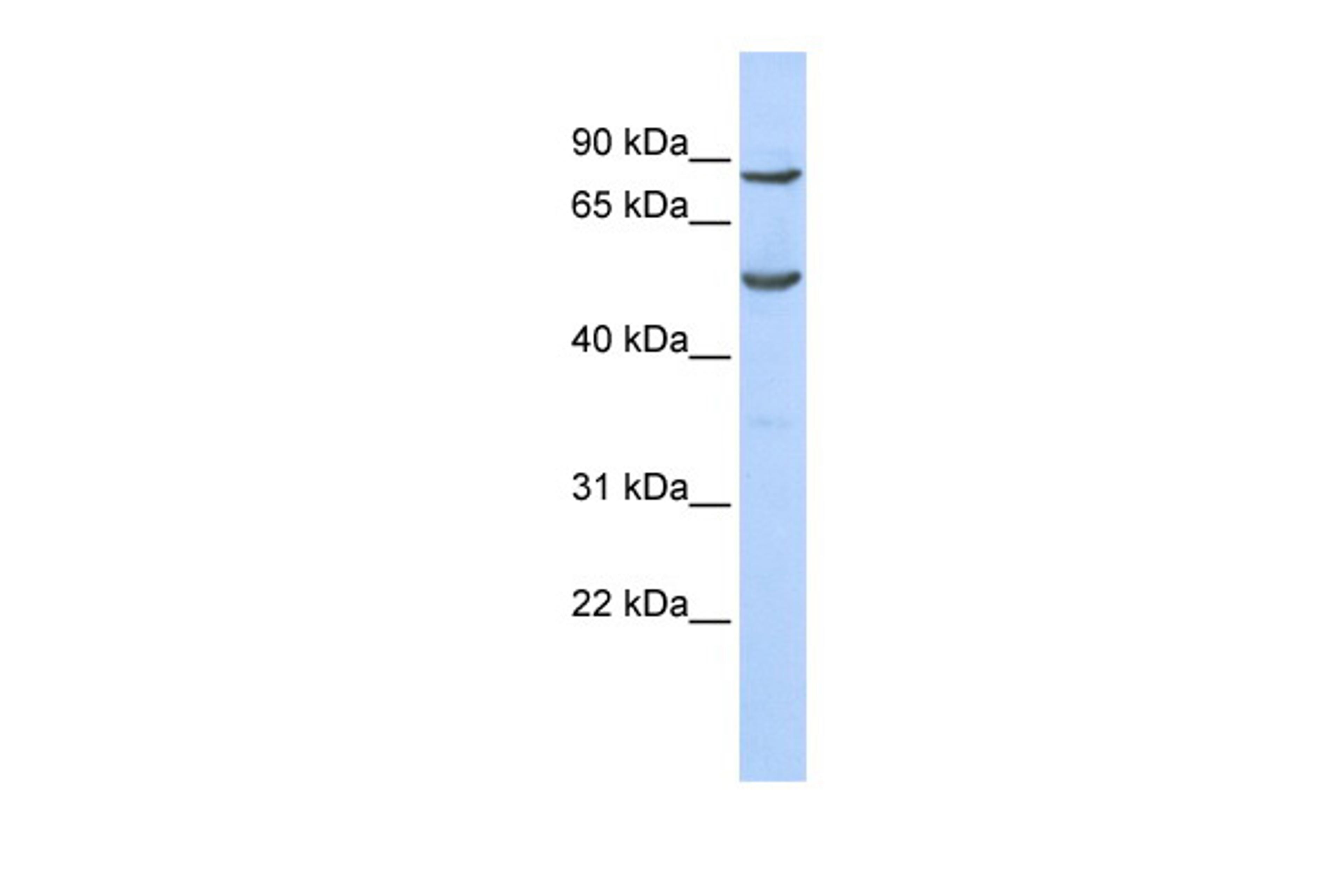 Antibody used in WB on Human 293T at 0.2-1 ug/ml.