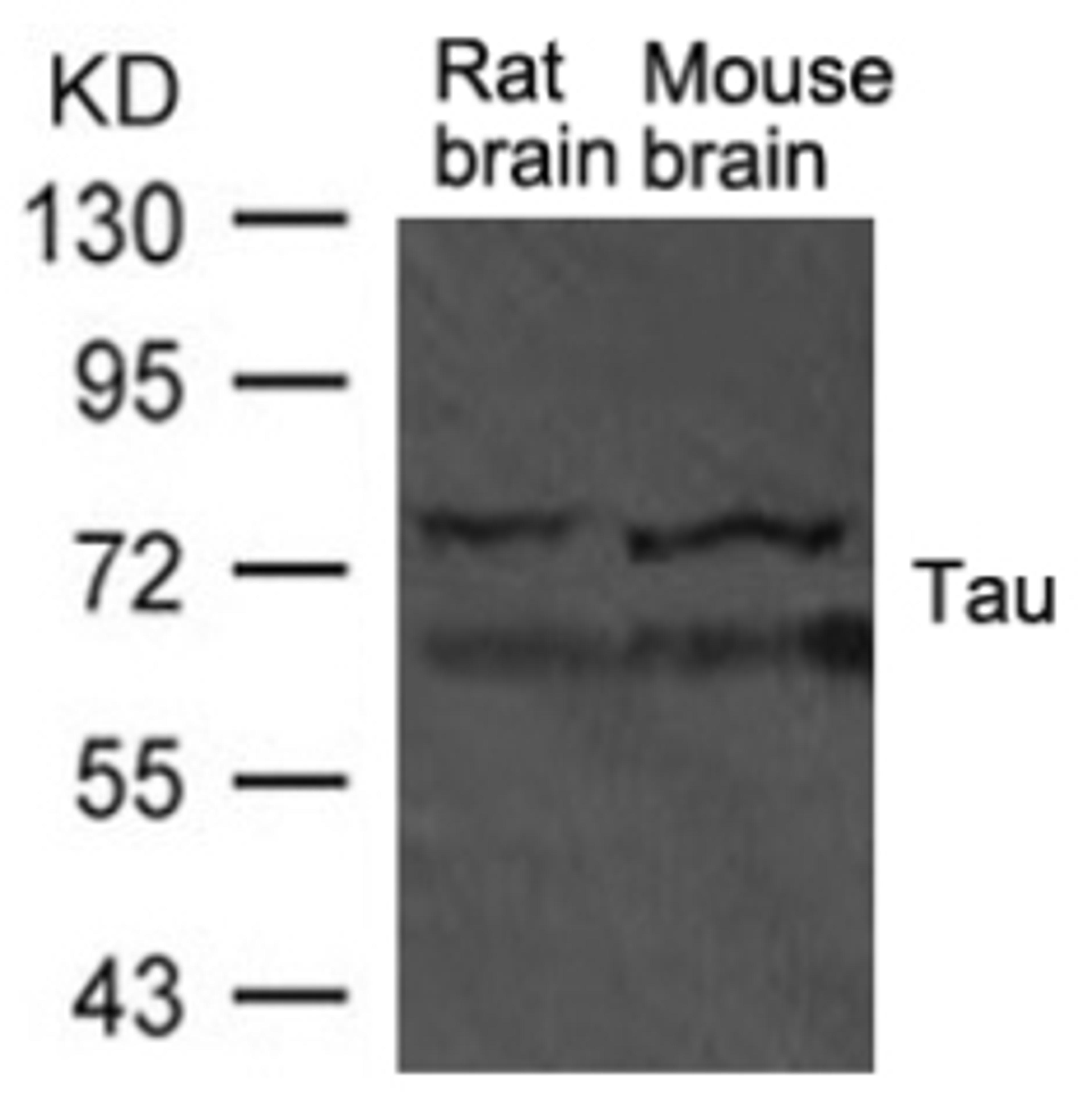 Western blot analysis of extract from rat brain and mouse brain tissue using TAU Antibody.