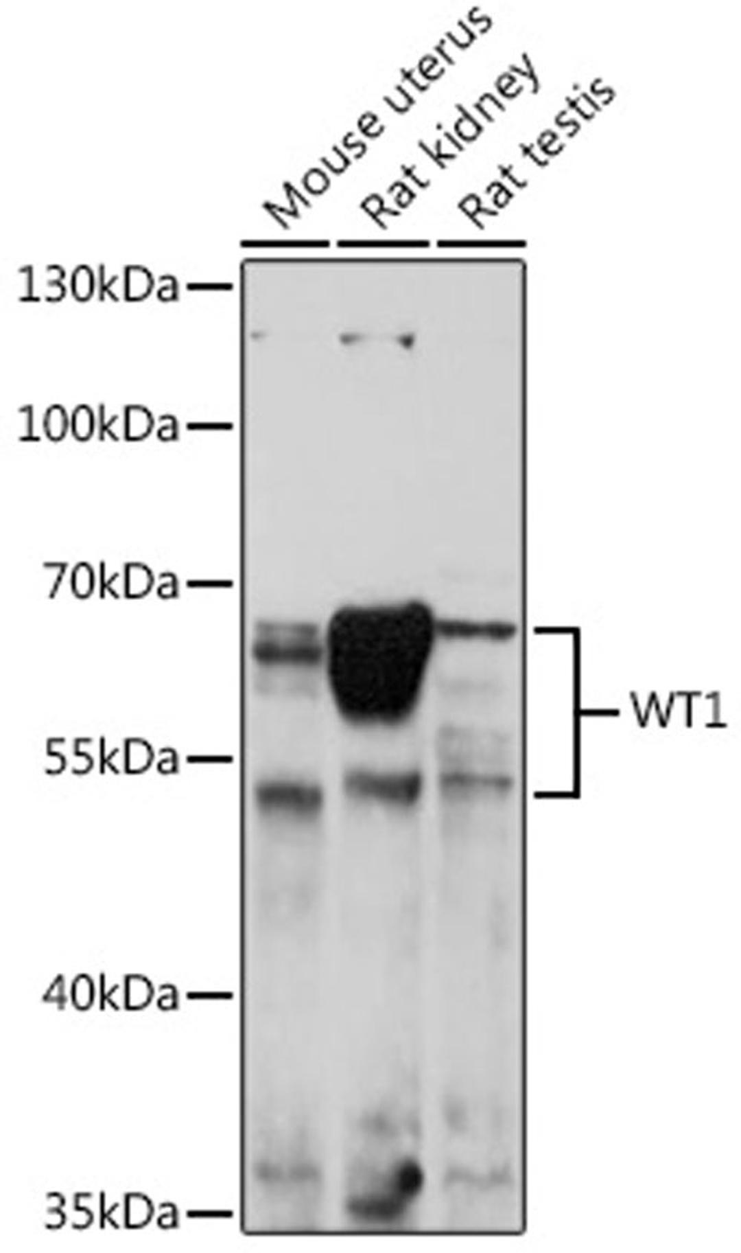 Western blot - WT1 antibody (A16298)