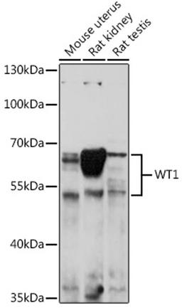 Western blot - WT1 antibody (A16298)