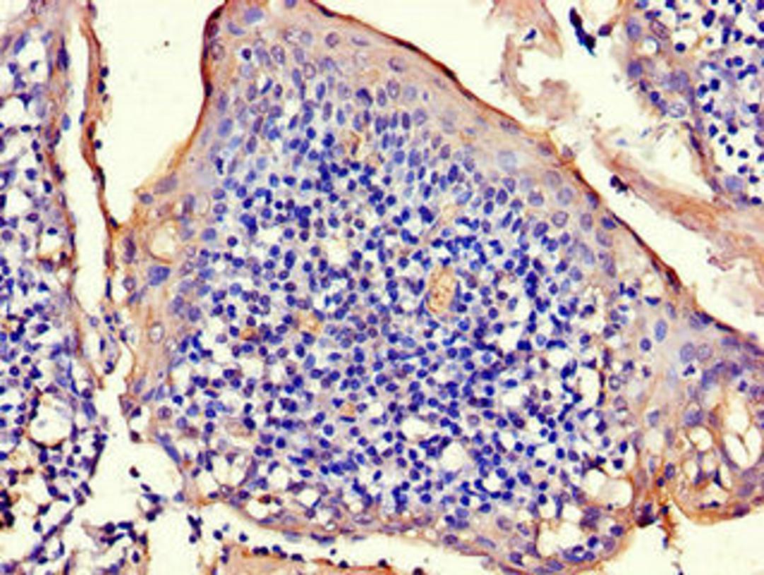 Immunohistochemistry of paraffin-embedded human tonsil tissue using CSB-PA896748LA01HU at dilution of 1:100