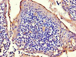 Immunohistochemistry of paraffin-embedded human tonsil tissue using CSB-PA896748LA01HU at dilution of 1:100