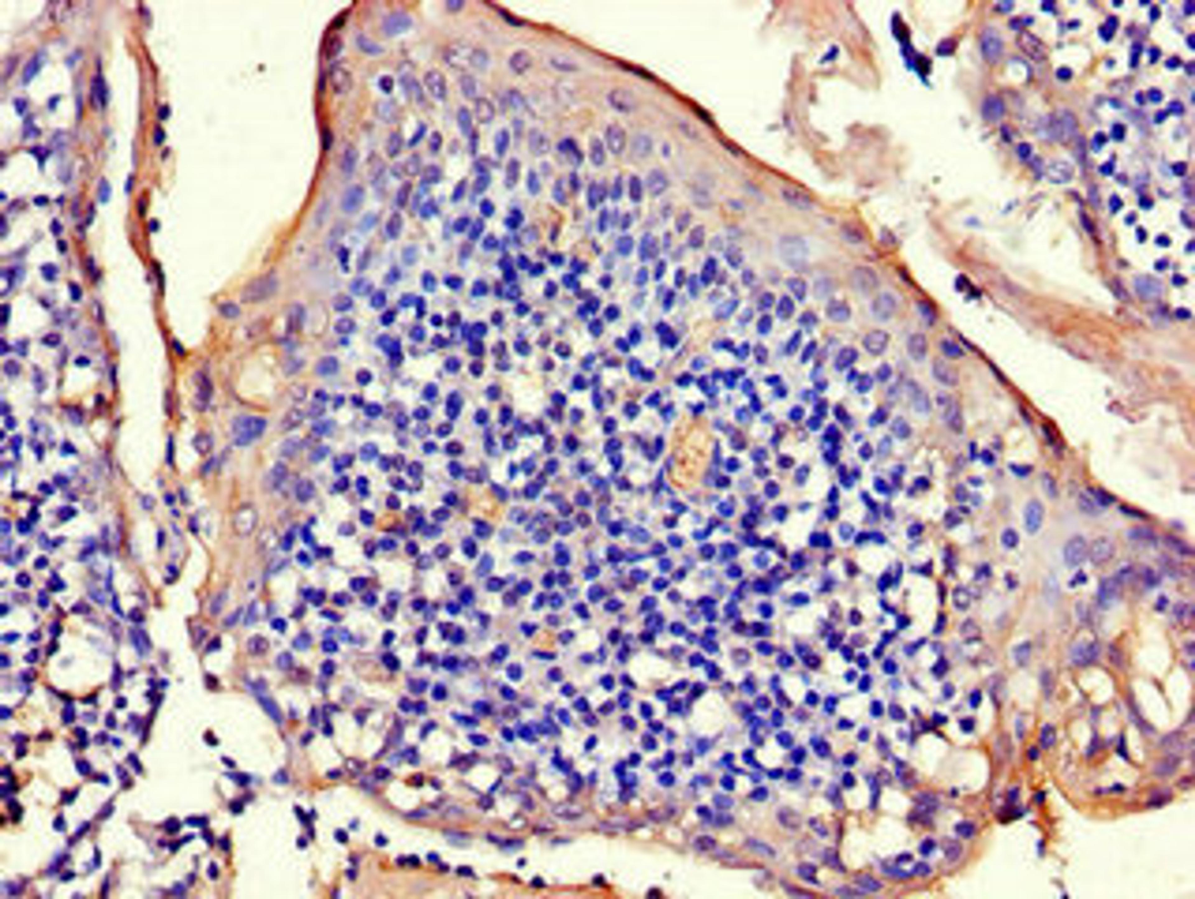 Immunohistochemistry of paraffin-embedded human tonsil tissue using CSB-PA896748LA01HU at dilution of 1:100