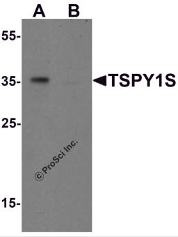 Western blot analysis of TSPY1S in A20 cell lysate with TSPY1S antibody at 1 &#956;g/mL in (A) the absence and (B) the presence of blocking peptide.