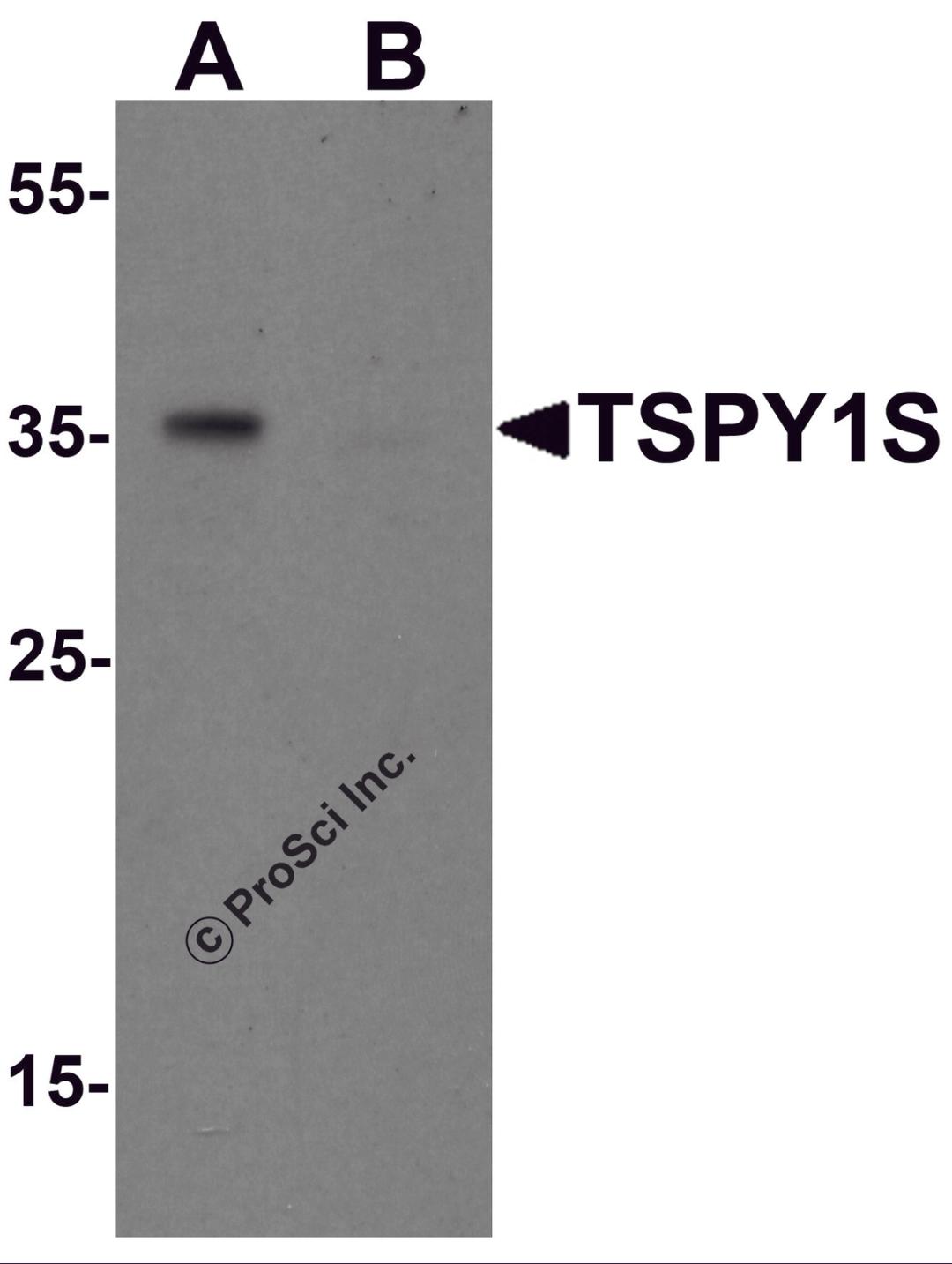 Western blot analysis of TSPY1S in A20 cell lysate with TSPY1S antibody at 1 μg/mL in (A) the absence and (B) the presence of blocking peptide.