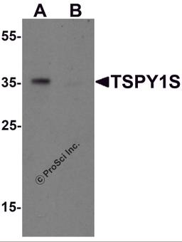 Western blot analysis of TSPY1S in A20 cell lysate with TSPY1S antibody at 1 μg/mL in (A) the absence and (B) the presence of blocking peptide.