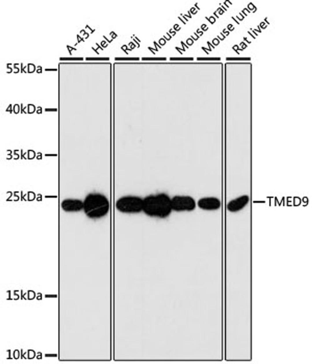 Western blot - TMED9 antibody (A3442)