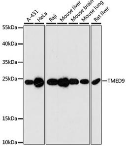 Western blot - TMED9 antibody (A3442)