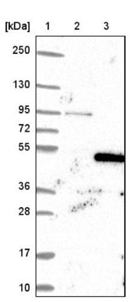 Western Blot: TAF8 Antibody [NBP2-38188] - Lane 1: Marker [kDa] 250, 130, 95, 72, 55, 36, 28, 17, 10<br/>Lane 2: Negative Control<br/>Lane 3: LY408568